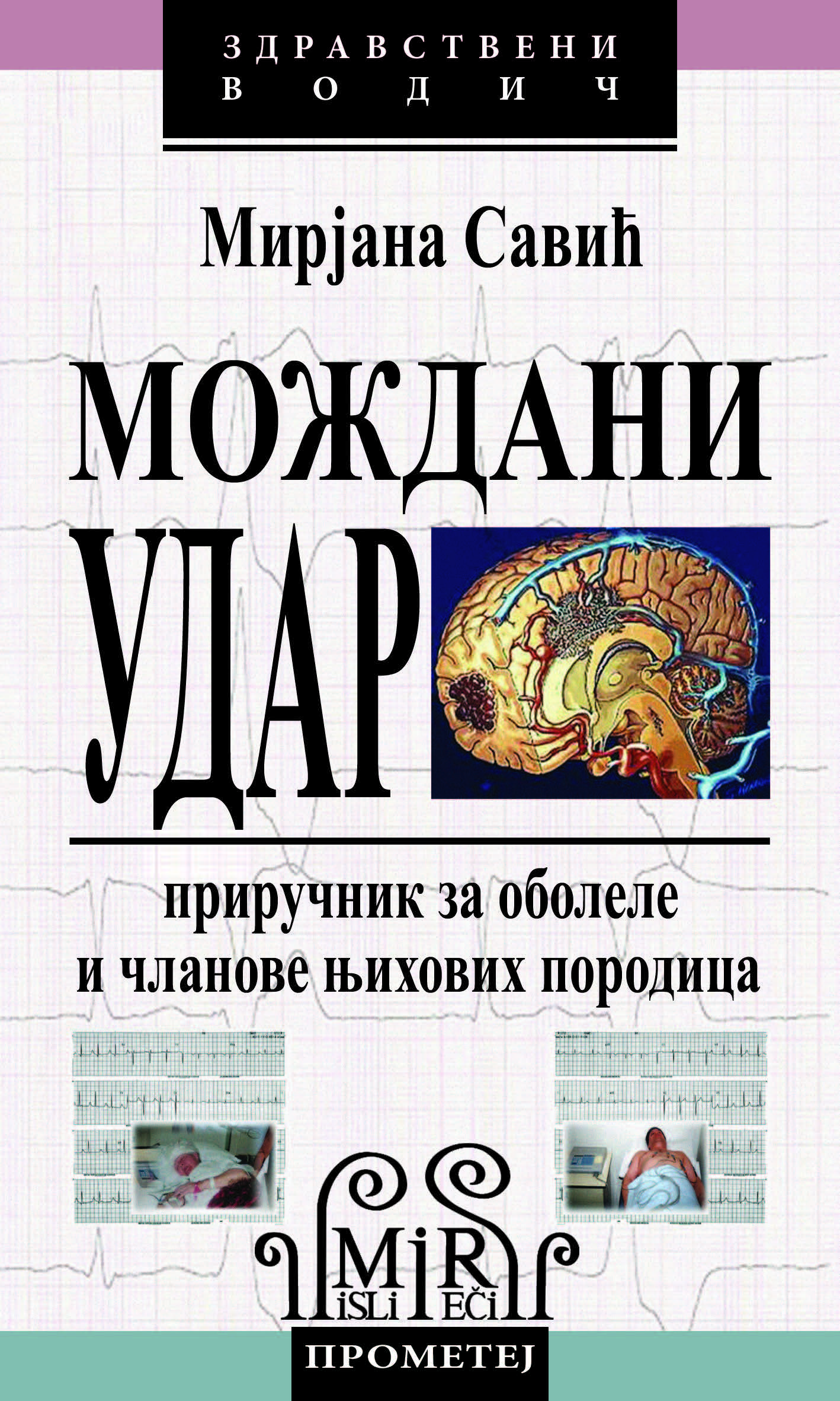 Мождани удар